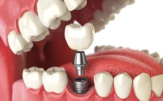 Hannover Finanz buys majority stake in Dental Direkt